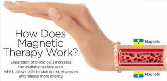 How work the magnetic therapy